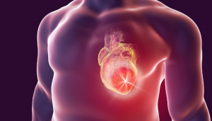 Infarto ou Ansiedade: Aprenda a Diferenciar os Sintomas