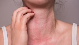 Alergia emocional: tudo sobre causas, tratamentos e o que ninguém te explica