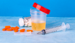 O que a cor da sua urina revela sobre sua saúde?