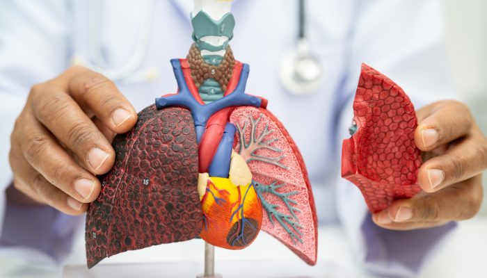 Pneumonia: identificando os sinais de alerta