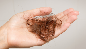 Vitaminas e minerais para queda de cabelo: o que realmente funciona?